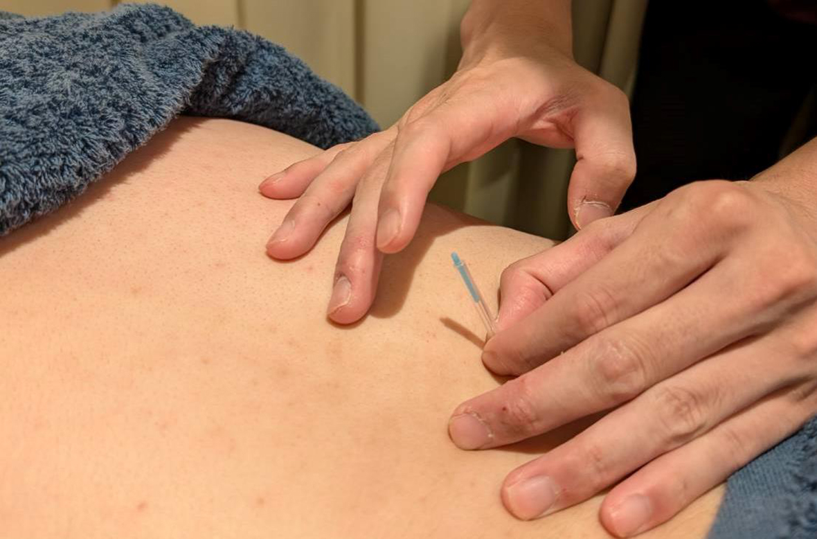 腰痛の施術について